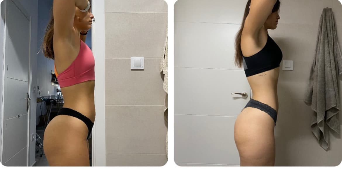 Transformación real de cliente 3 — antes y después